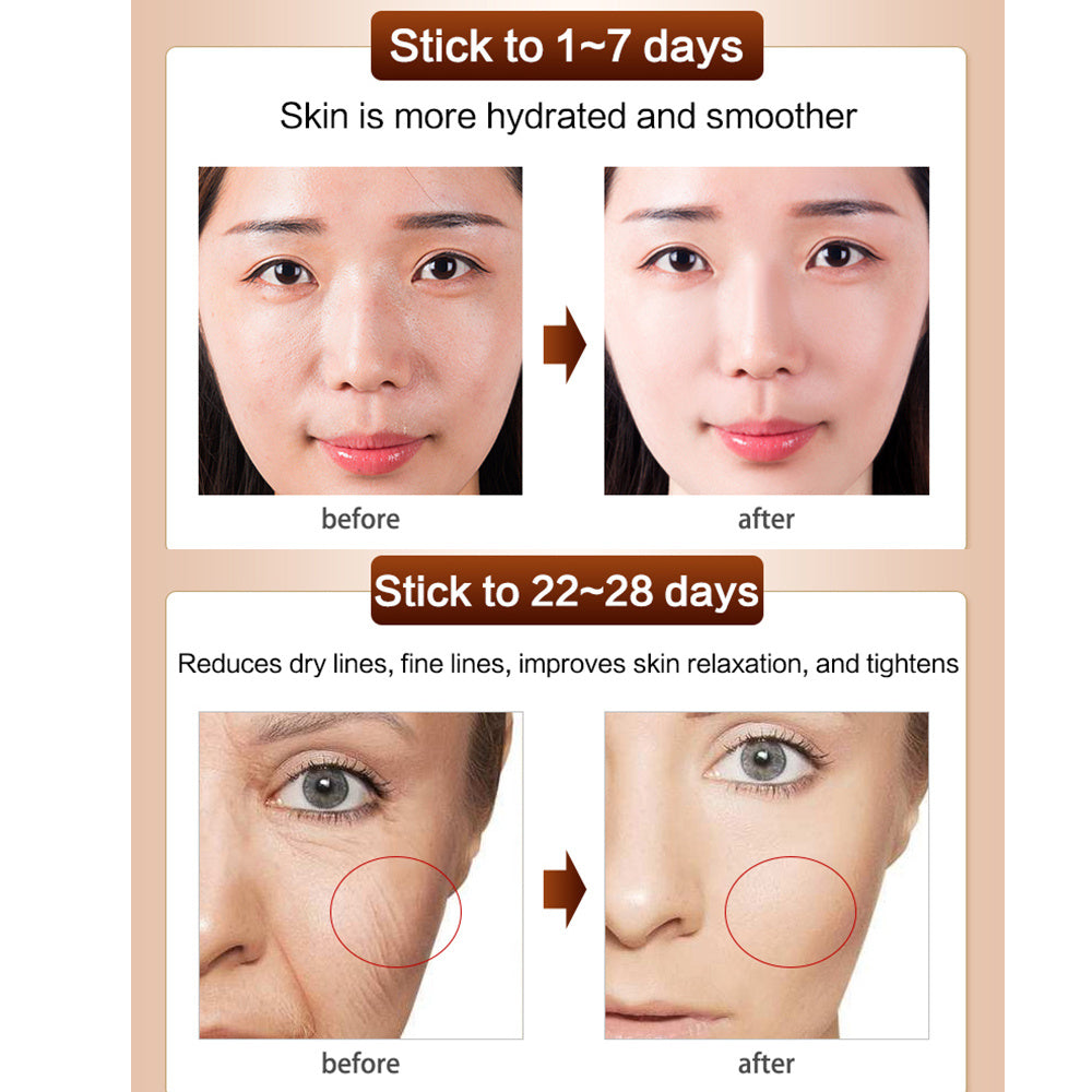 Anti-Wrinkle Cream