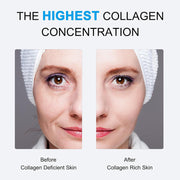 Collagen Anti-Wrinkle Facial Mask – Lifts, Firms & Brightens Skin