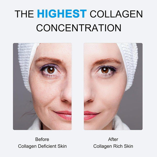 Collagen Anti-Wrinkle Facial Mask – Lifts, Firms & Brightens Skin