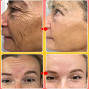 Retinol Royal Age Longxue Cream