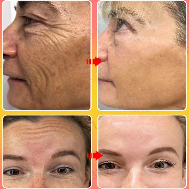 Retinol Royal Age Longxue Cream